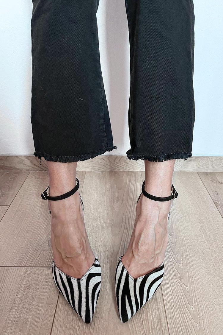 Sunshine | Zebra Print Pumps With Ankle Strap